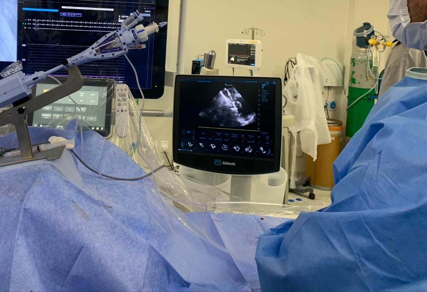 Dr. Bruno Sessa realizando procedimento por cateter em sala de hemodinâmica
